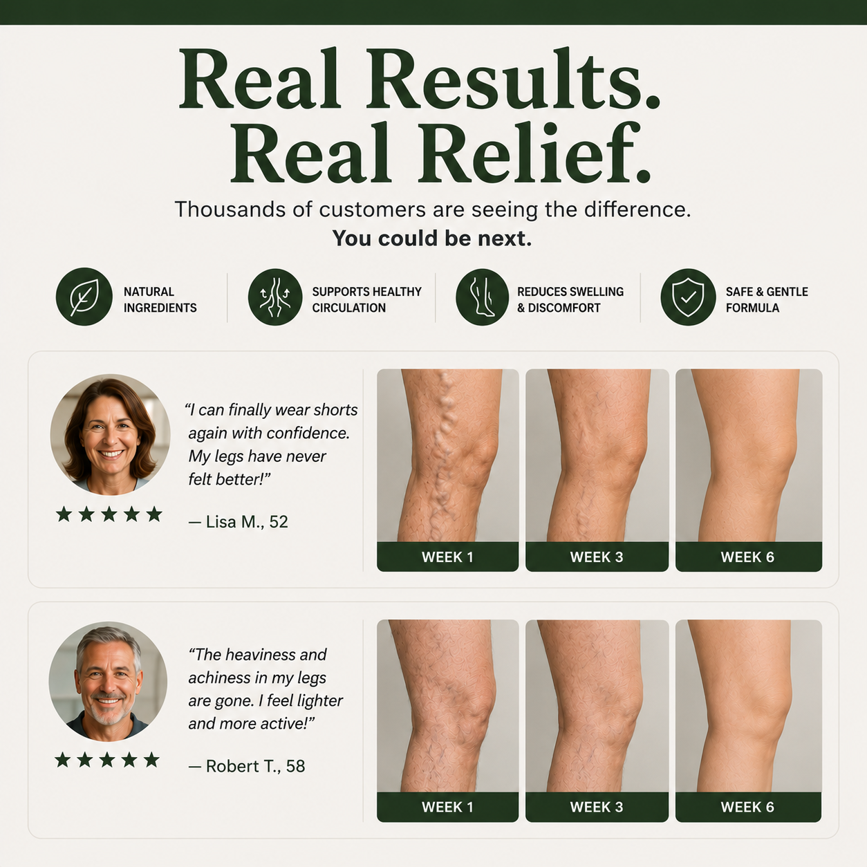 Varicose Veins Relief Patches